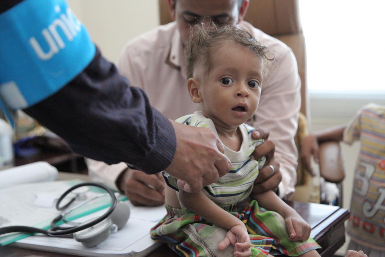 A boy is treated for malnutrition in Yemen.