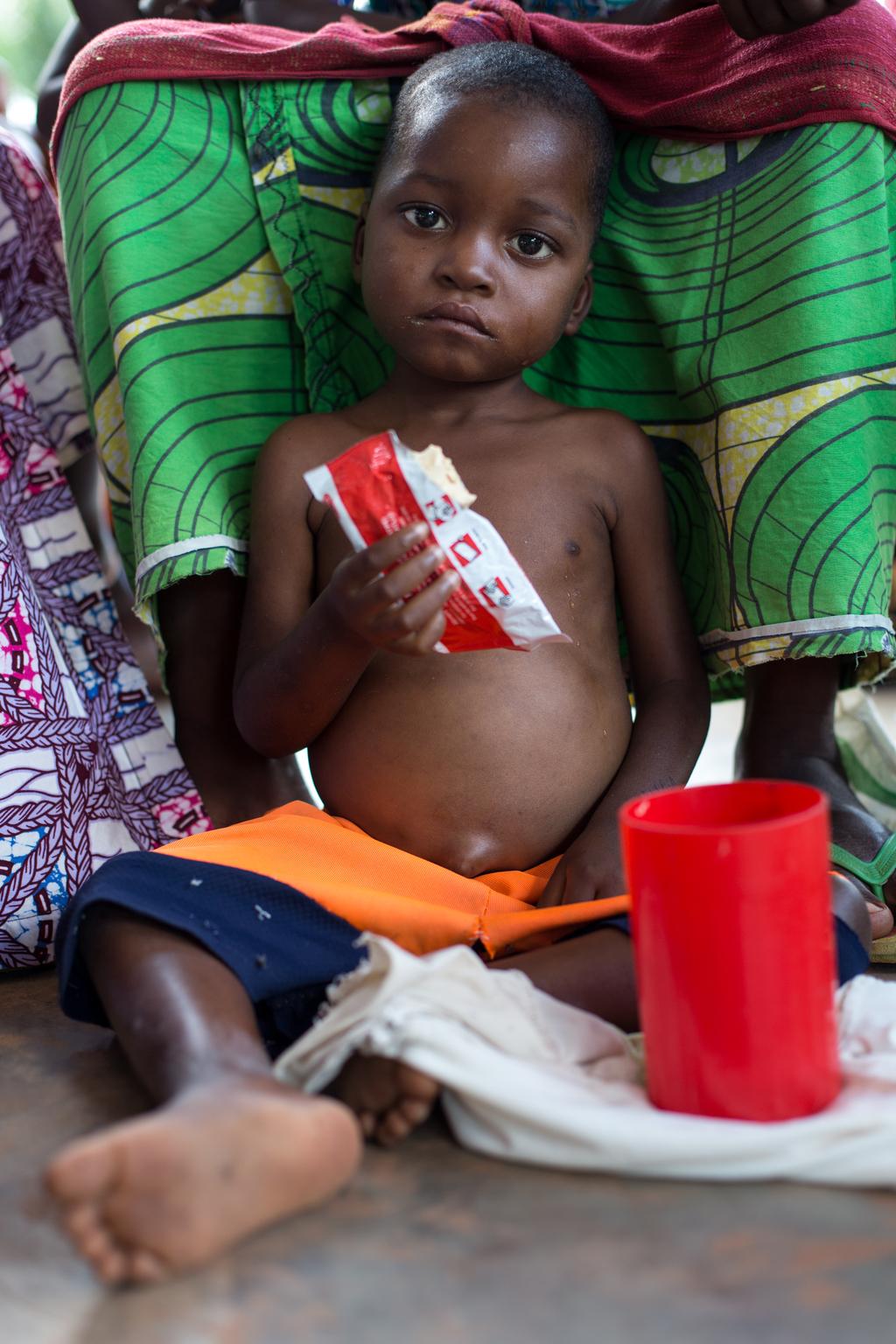 Un enfant souffrant de malnutrition mange un aliment thérapeutique prêt à consommer