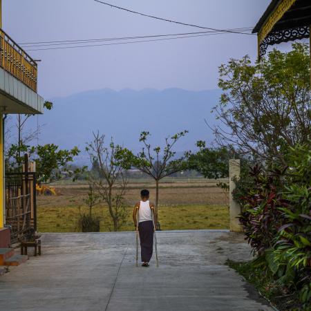 14-year-old Paing, from Kayah State, stepped on a landmine while searching for his family’s injured cow at a neighborhood farm in eastern Myanmar. His lost his right leg, and his hands & other leg were badly injured.