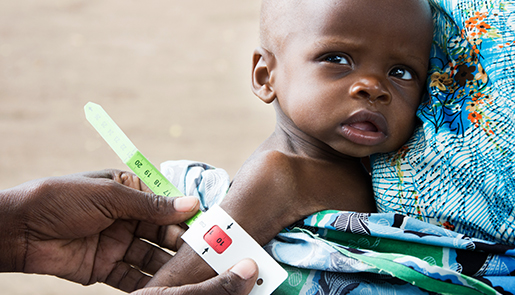 Child wearing a MUAC bracelet