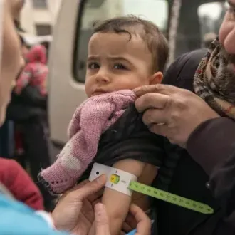 A worried toddler is held by an adult while a health worker measures the child’s upper arm with a green MUAC tape; a pink sweater drapes nearby.