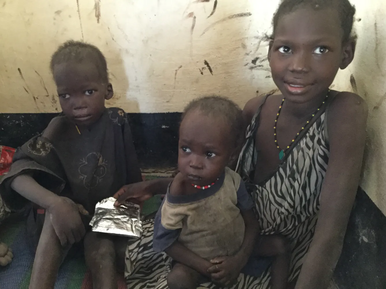 Children receiving treatment for acute malnutrition at a UNICEF-supported clinic in Rubkona.