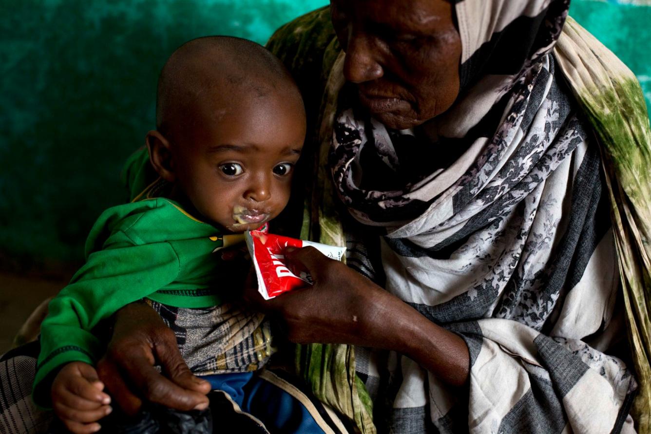 Somalia malnutrition
