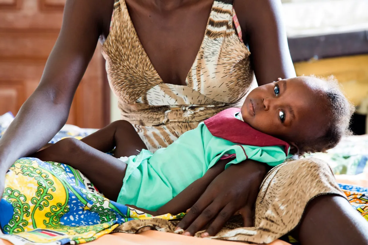 Elizabeth Kegi, 18 months, suffers from severe malnutrition.