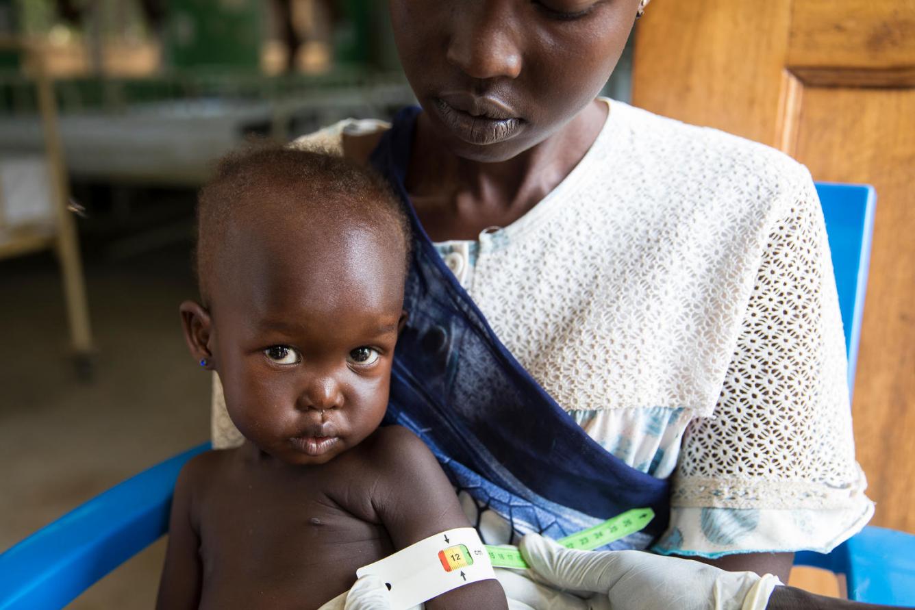 bebe, malnutrition, Soudan du Sud