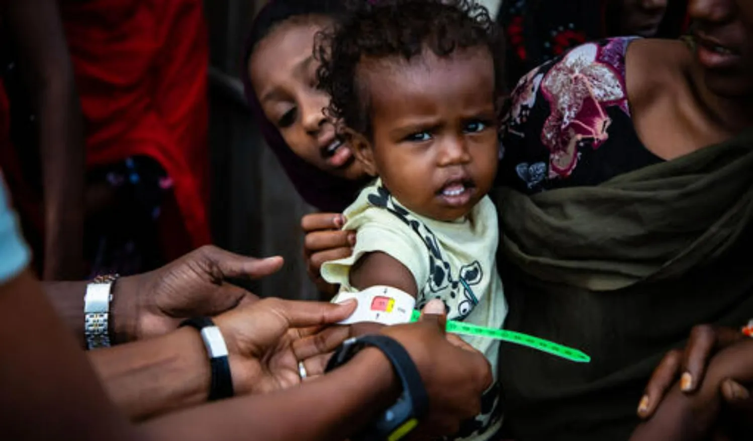 A health worker screens a young girl with a MUAC (Mid-Upper Arm Circumference) bracelet