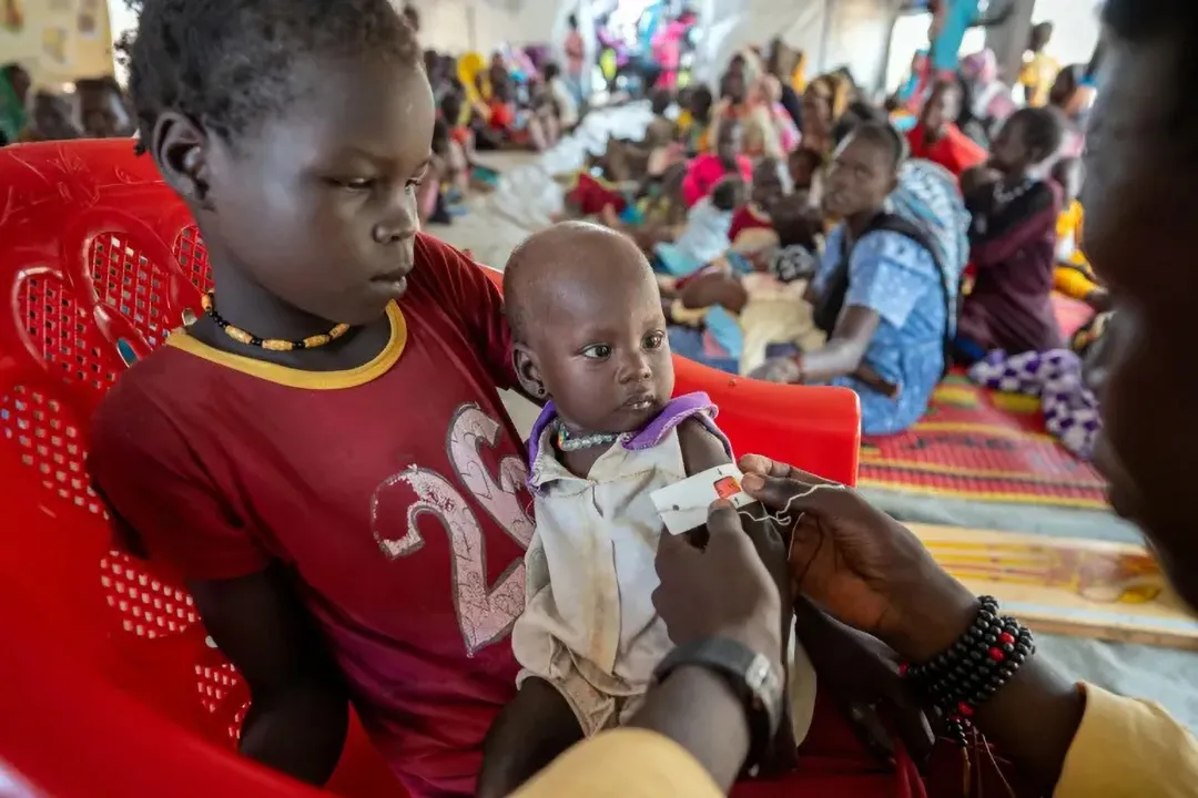 A young child sits in a red chair, holding an infant being assessed for malnutrition in a crowded room. The scene is serious and focused on well-being.
