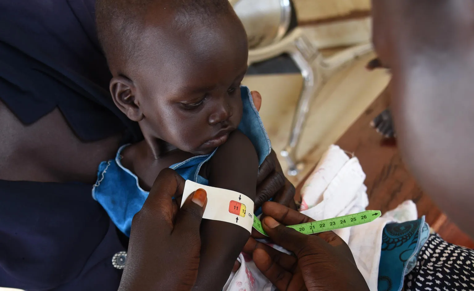 A health care worker is measuring children's upper arm circumference. 