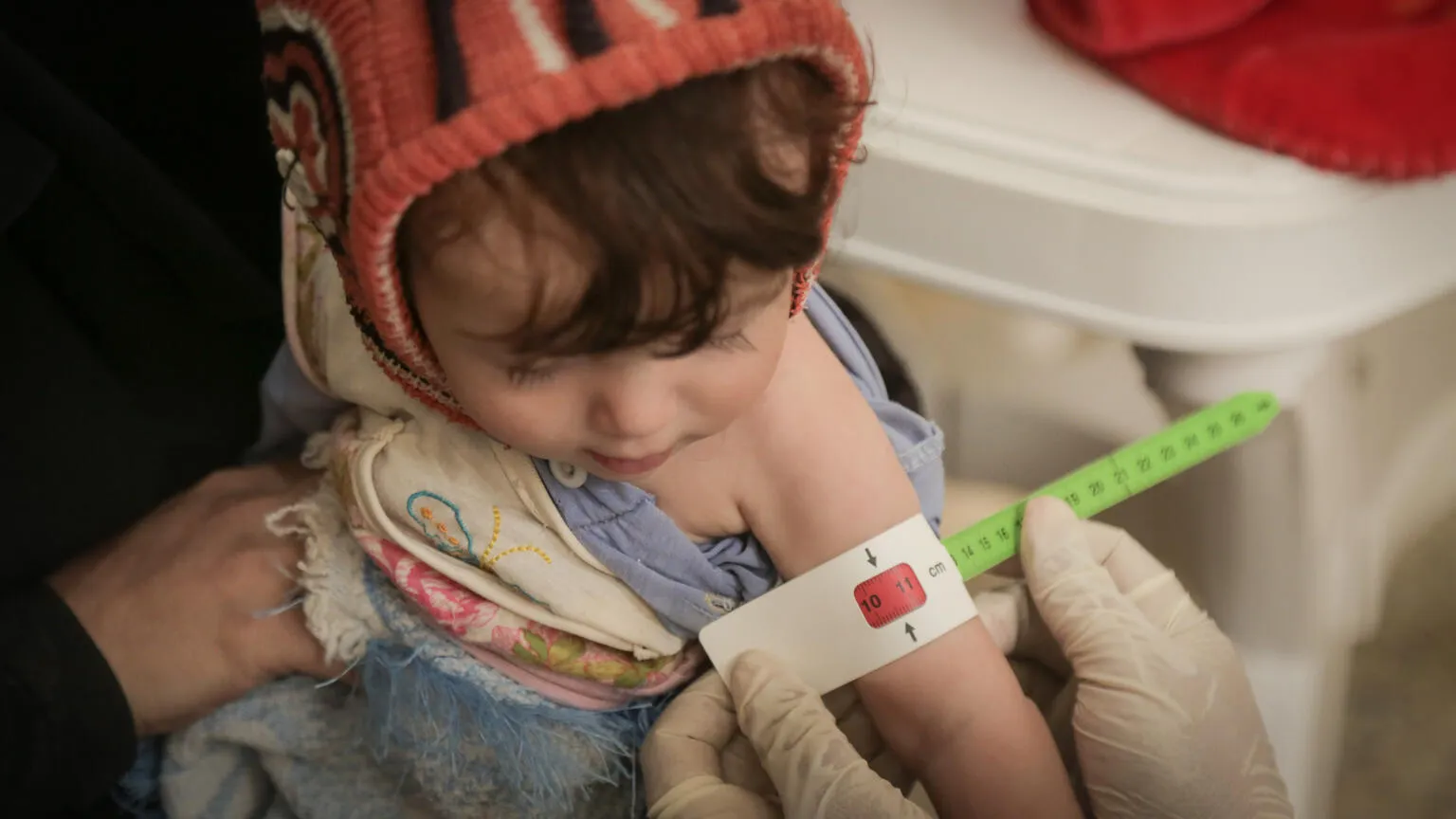 On 4 June 2020 in Yemen, Amal is measured while being screened for severe acute malnutrition at Arhab Health Centre in Sana'a Governorate.