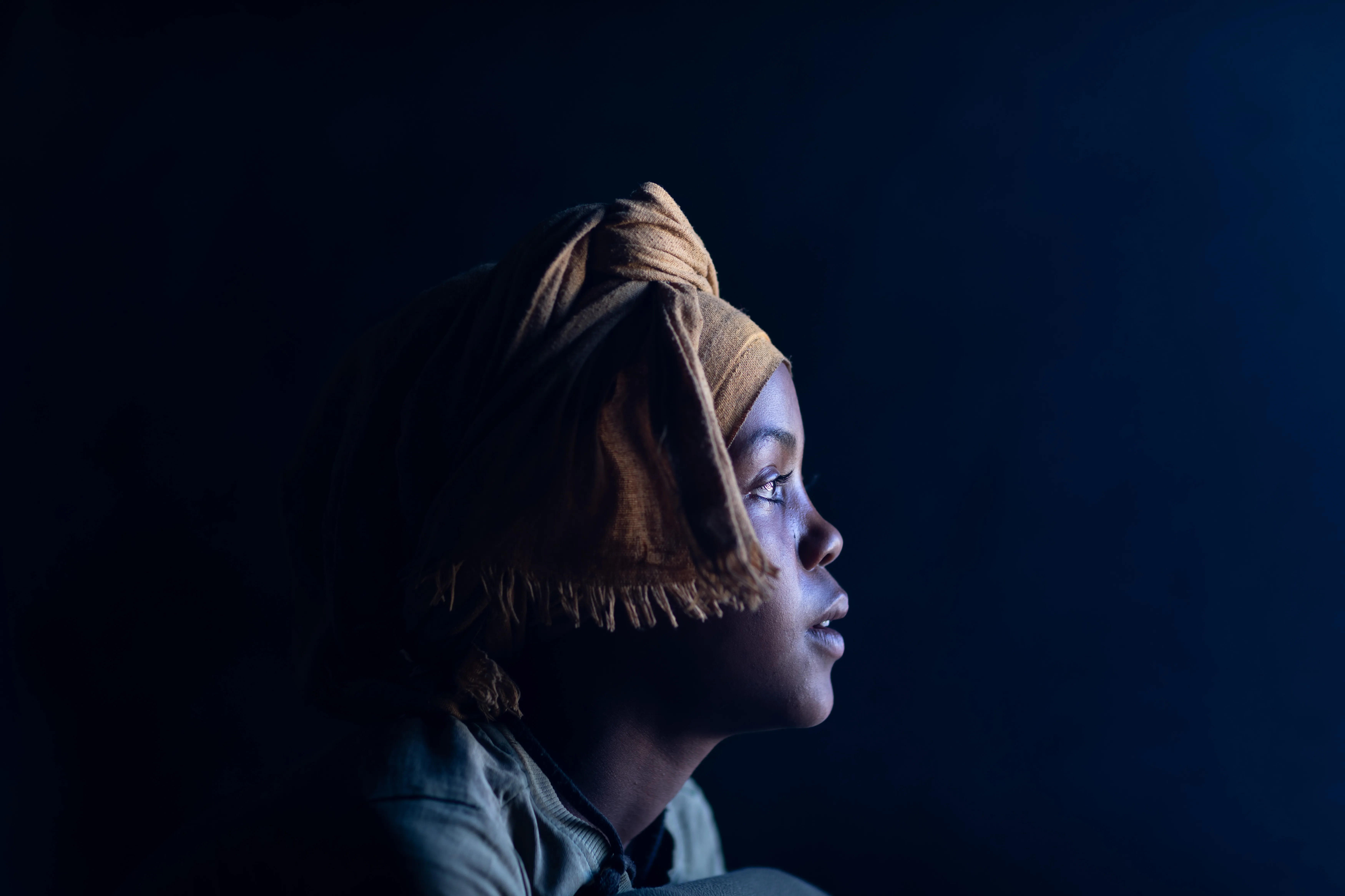 FGM