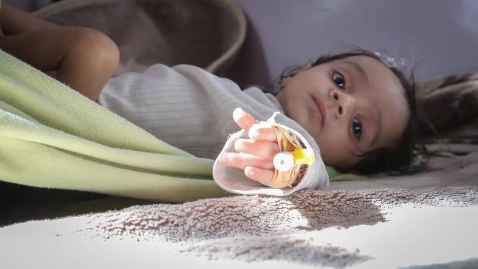 A baby gets measured for malnutrition