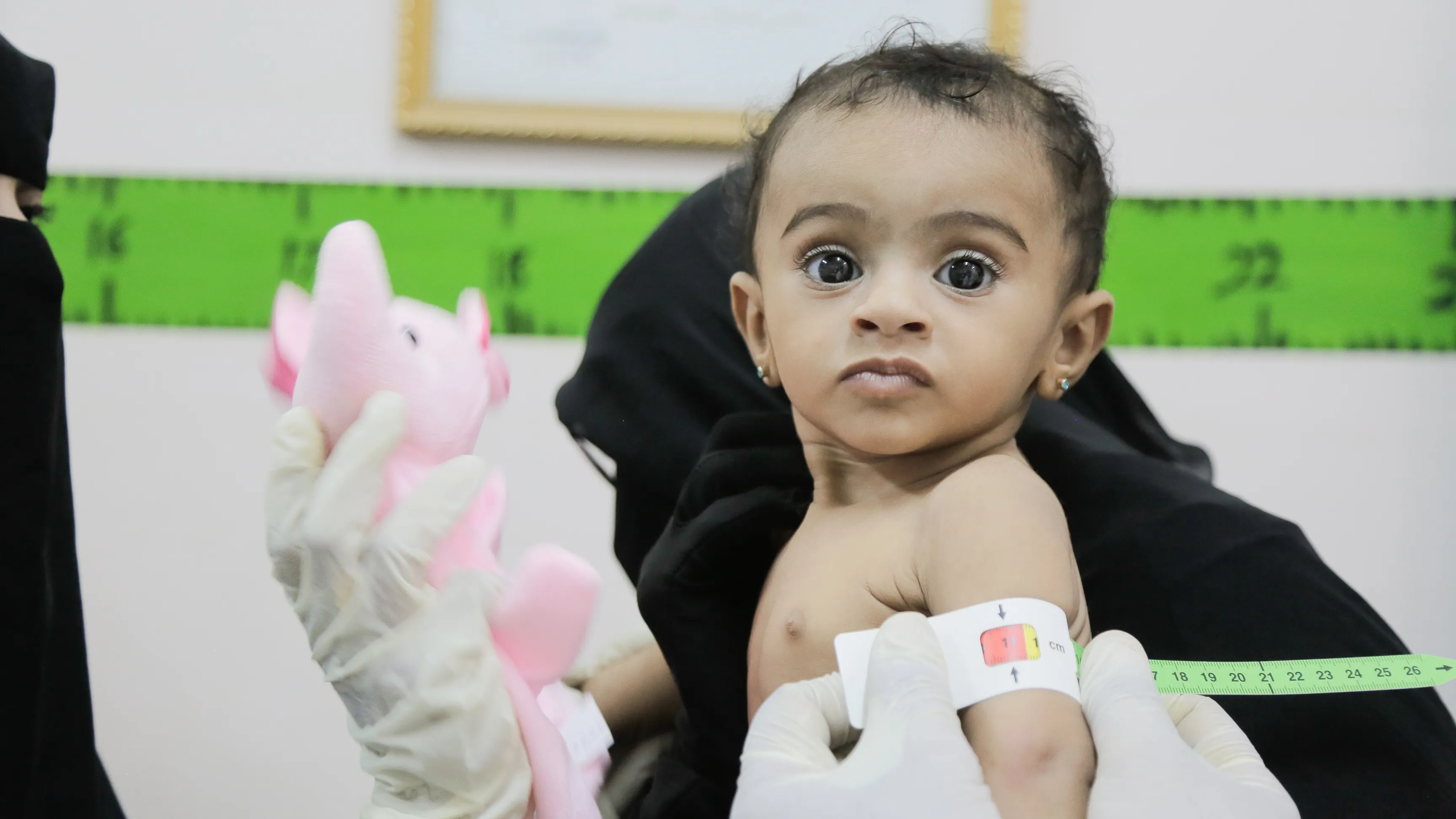 The child Imetanan Taha is 7 months old is being screened for malnutrition while visiting AlQutaee Stabilization Therapeutic Feeding Centre in AlMarawi’ah district, Hudaydah Gov, Yemen.