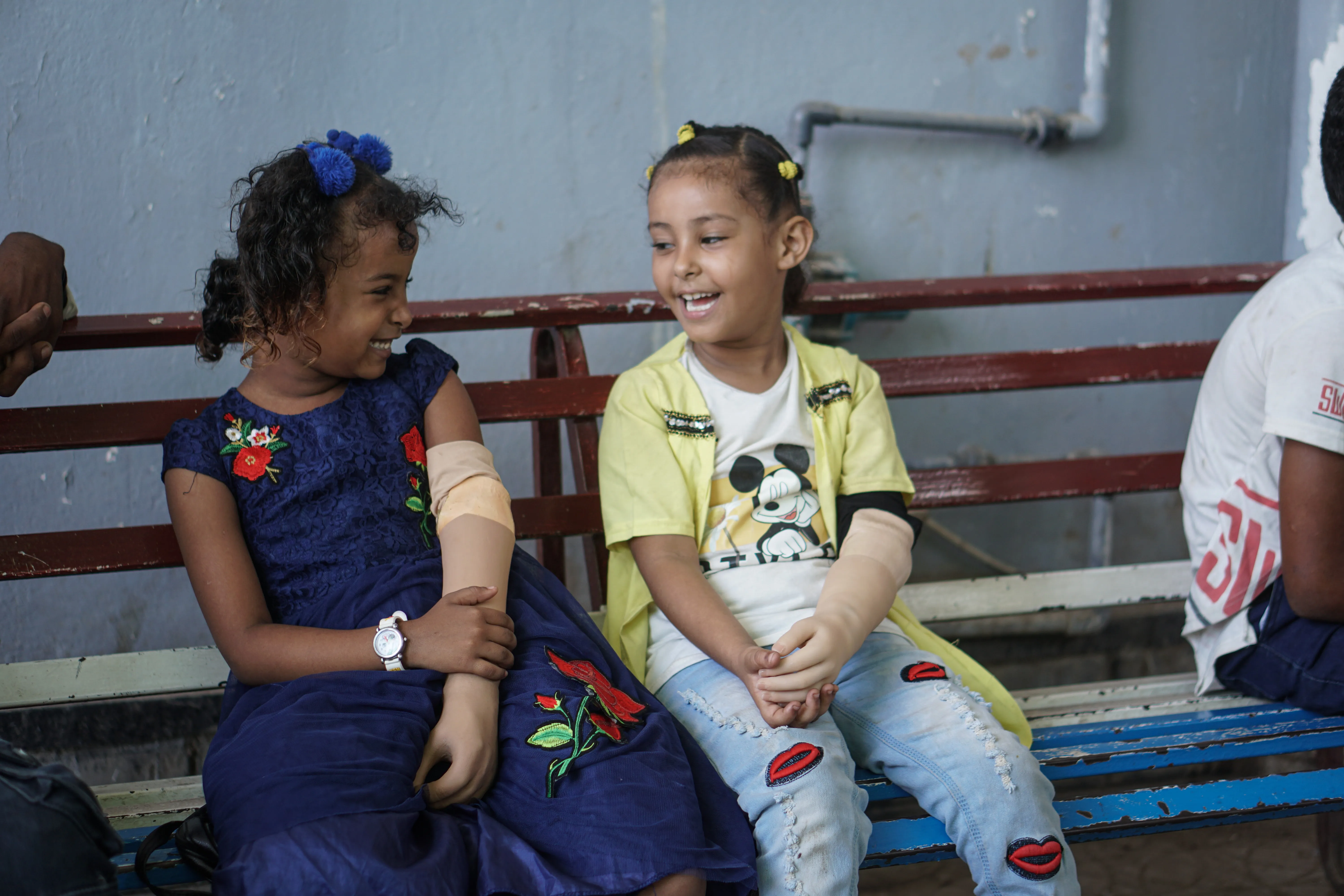 Malk, 7, and Abrar, 7, in the prosthetics centre in Aden, Yemen on 14 October 2021. Both children have a congenital disability and are receiving treatment in the centre