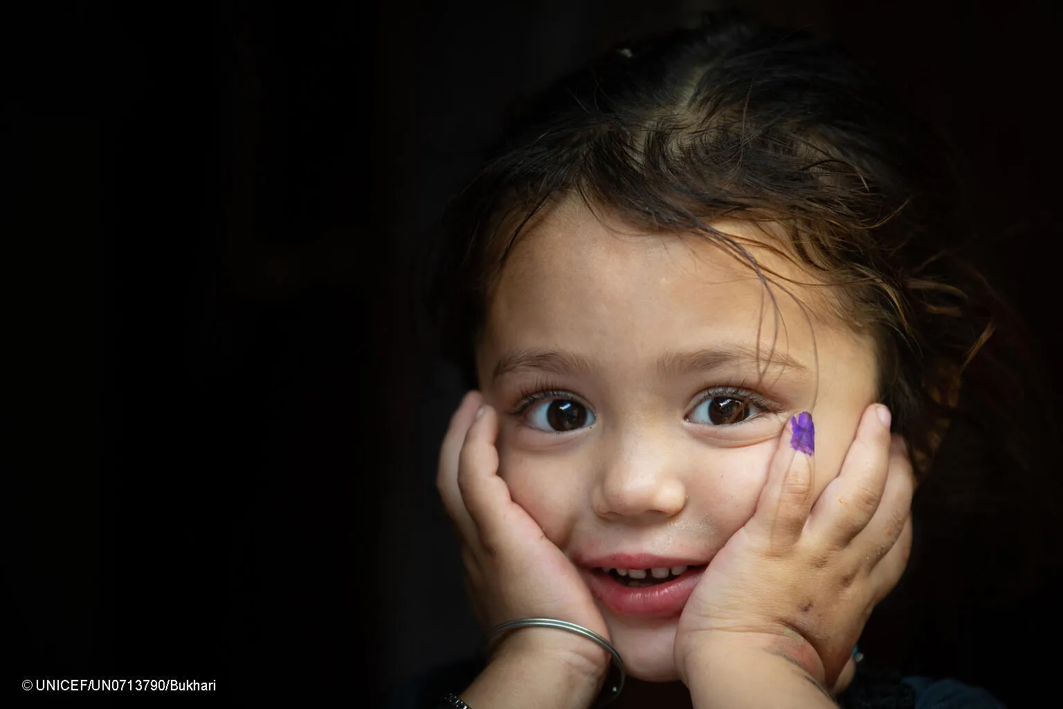 4-year-old Gul-e-Rukh poses for the UNICEF camera, showing her marked finger after receiving the polio vaccine, in Karachi, Pakistan.