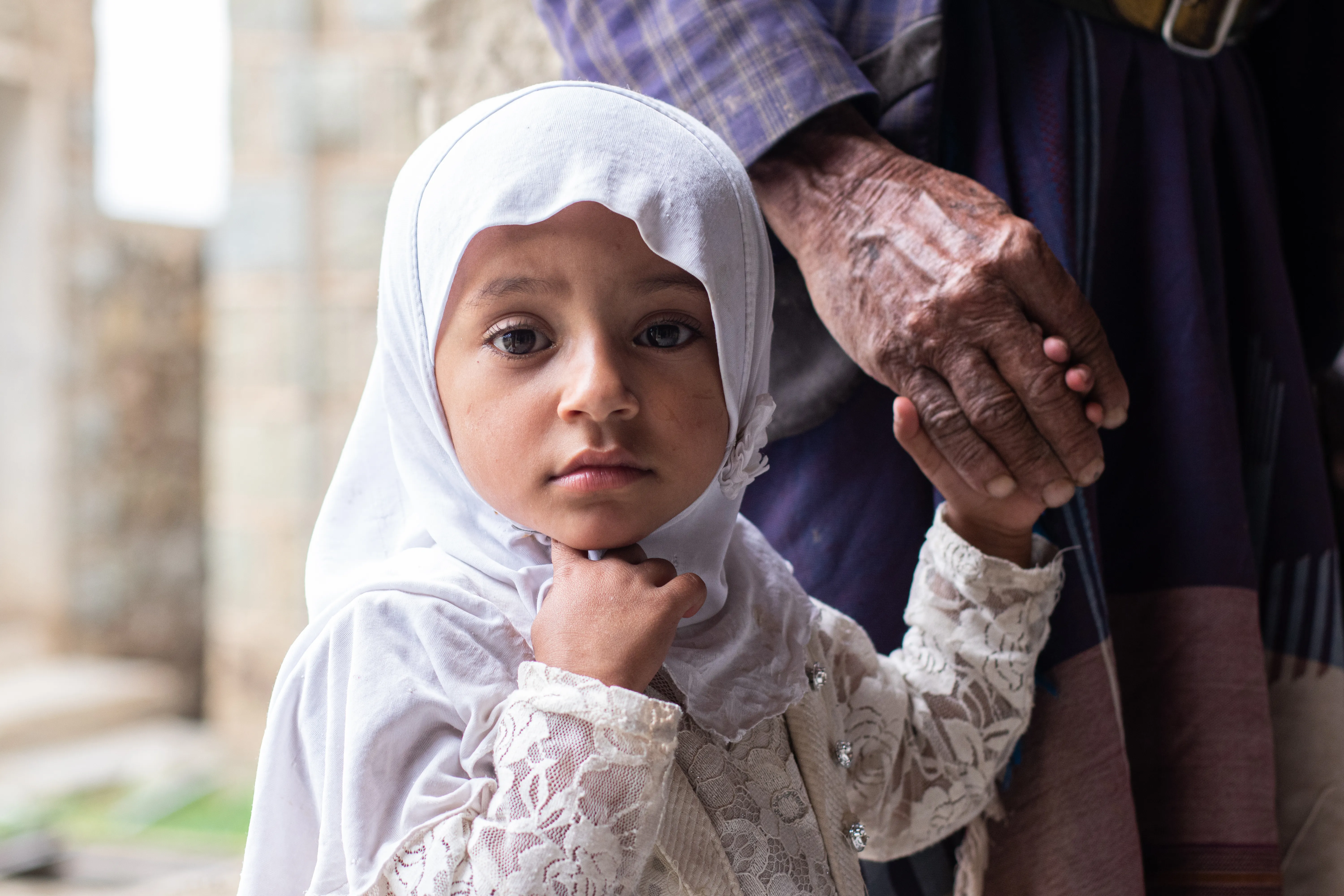 Somaya, 2 years old, is one of the children who came with her father, Walid Mohammed Ahmed Hassan, to get medical attention from the mobile clinic in Mazhar District, Raymah Governorate.