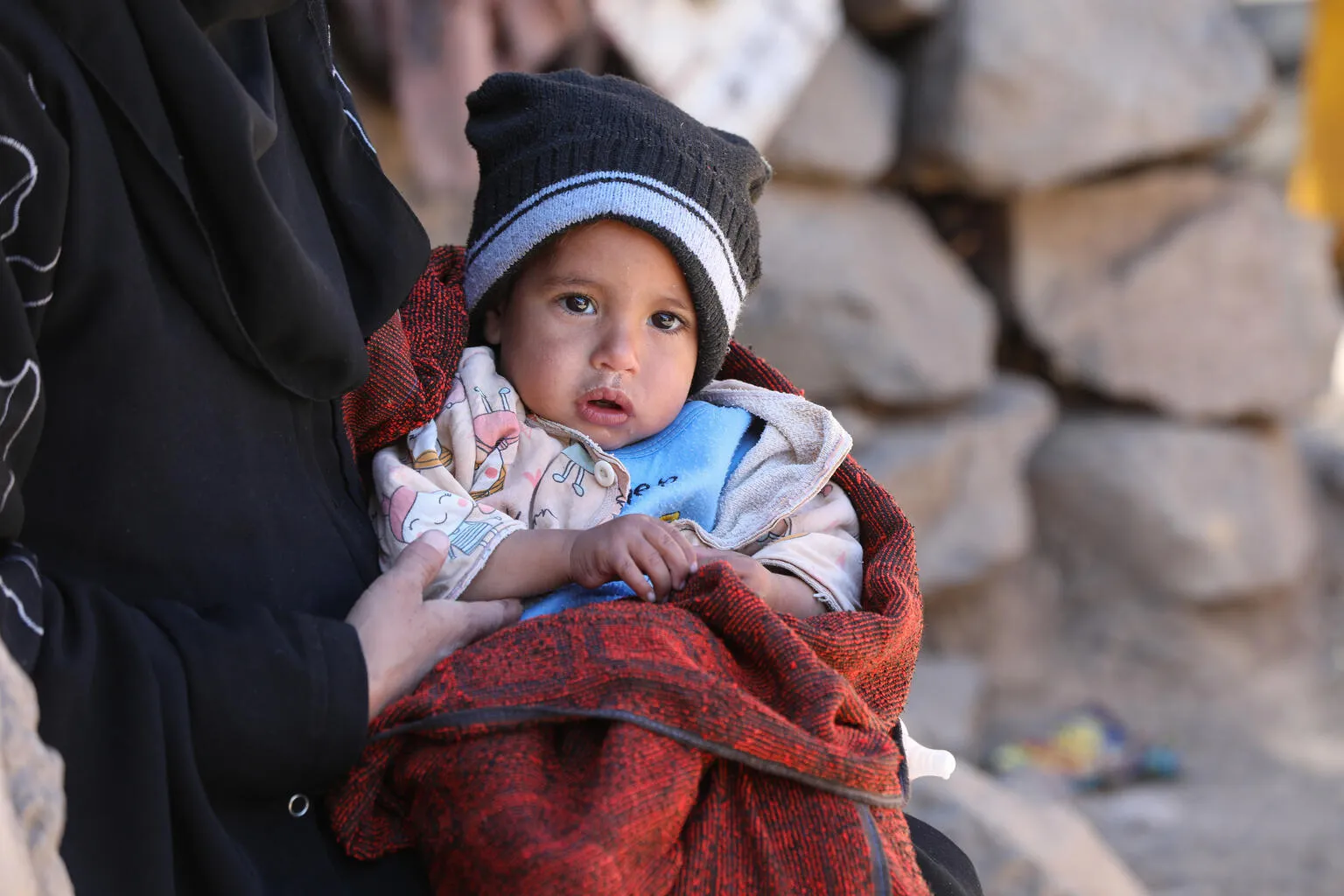 The beneficiary Abdulkarim Mohammed Saleh, one of the infants who were suffers of malnutrition and be treated by the UNICEF project in Alsari Village, Ibb Governorate, Yemen.