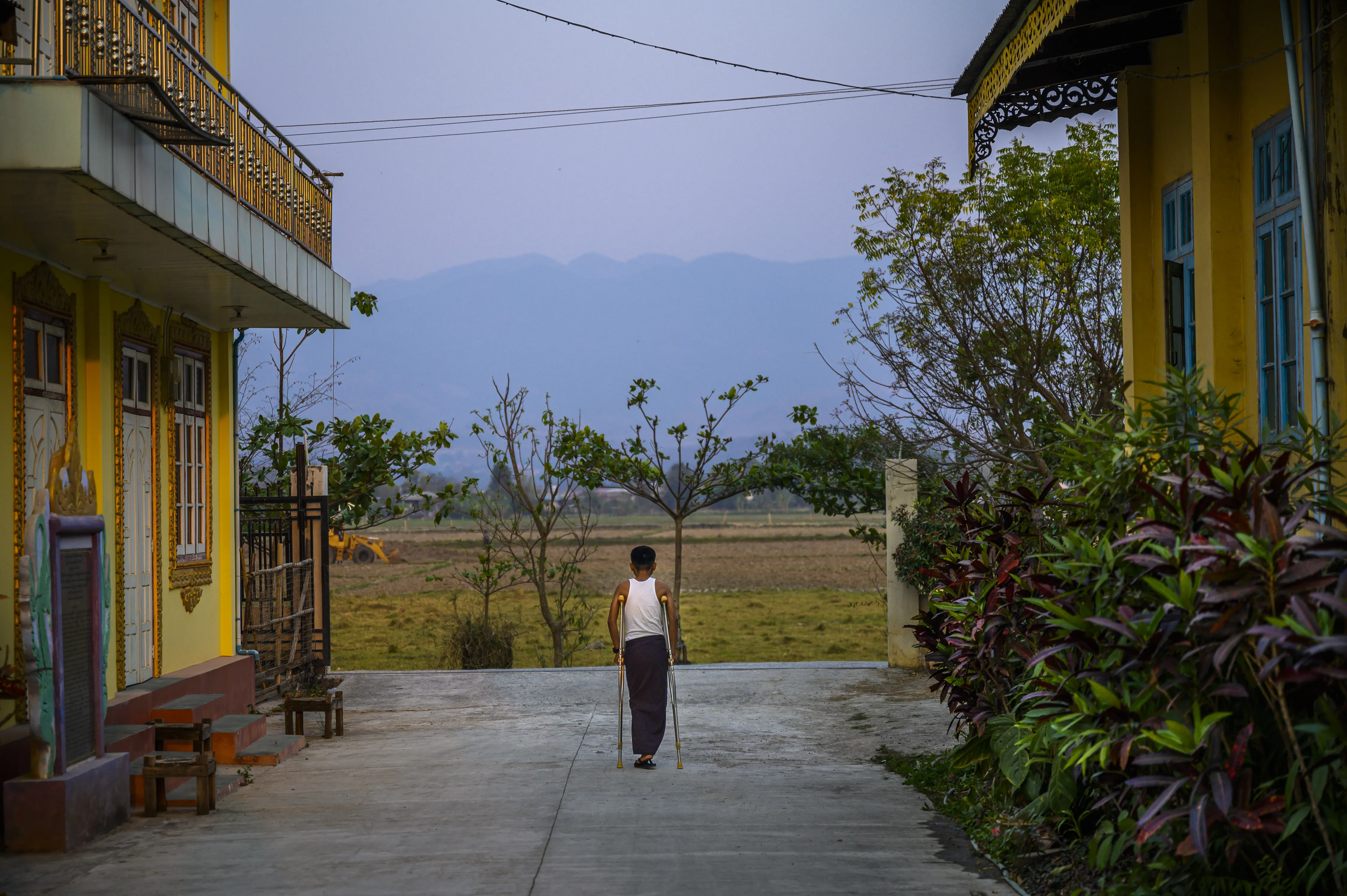 14-year-old Paing, from Kayah State, stepped on a landmine while searching for his family’s injured cow at a neighborhood farm in eastern Myanmar. His lost his right leg, and his hands & other leg were badly injured.