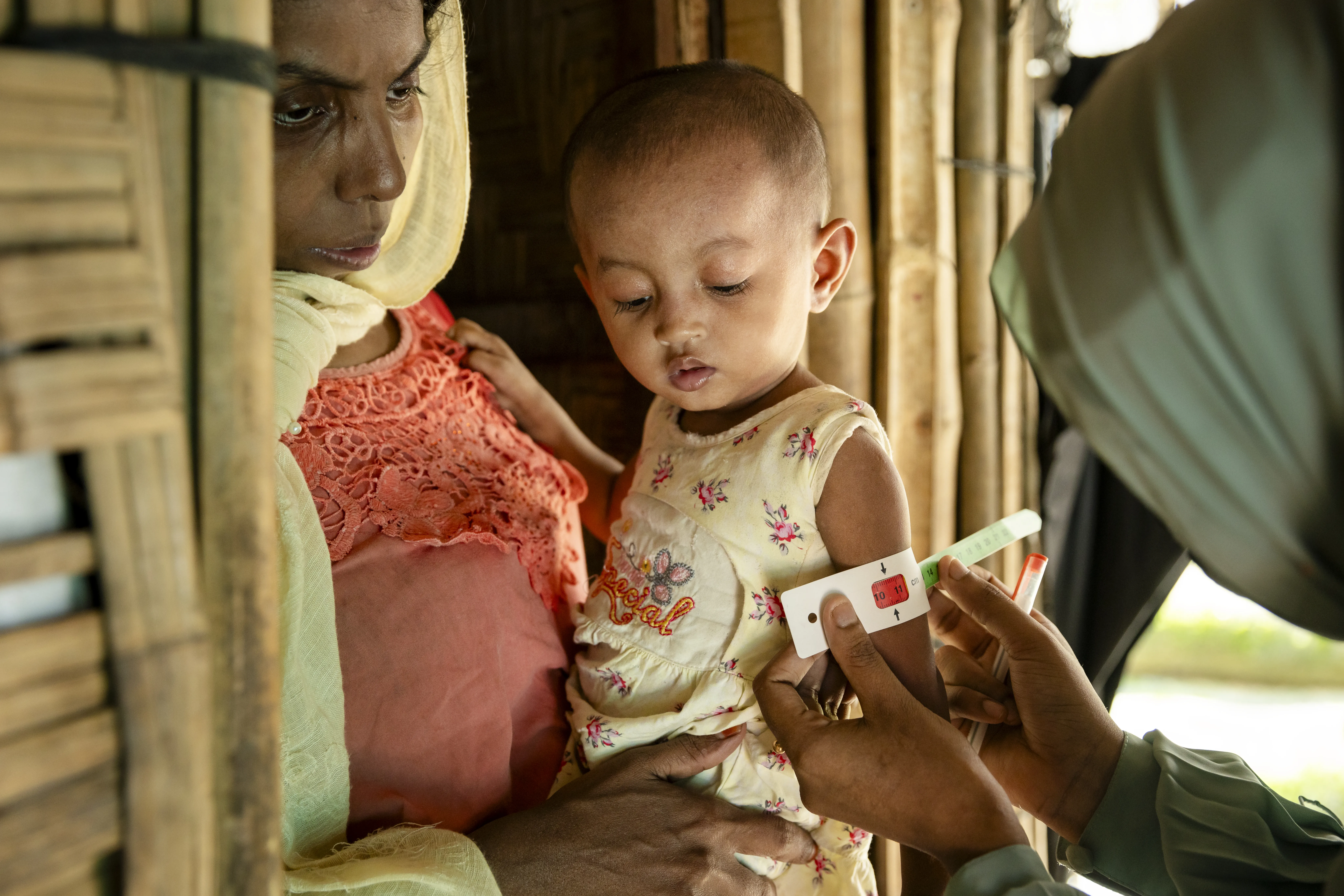 A child being screened for malnutrition in Cox’s Bazar, Bangladesh.