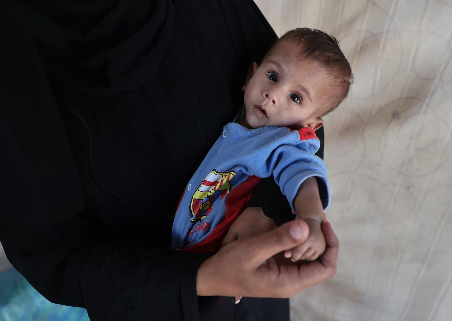 A malnourished baby in a blue and red outfit with a colorful emblem rests in his mother's arms, looking up with a tired expression. The person wears a black garment, suggesting a gentle and protective tone.
