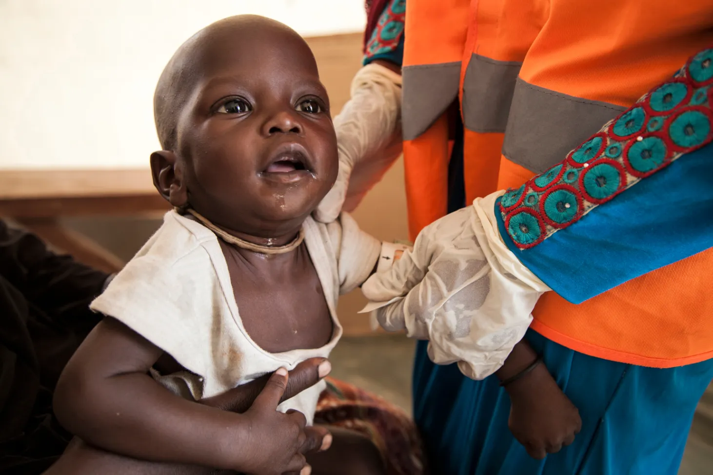 Nigeria malnutrition 