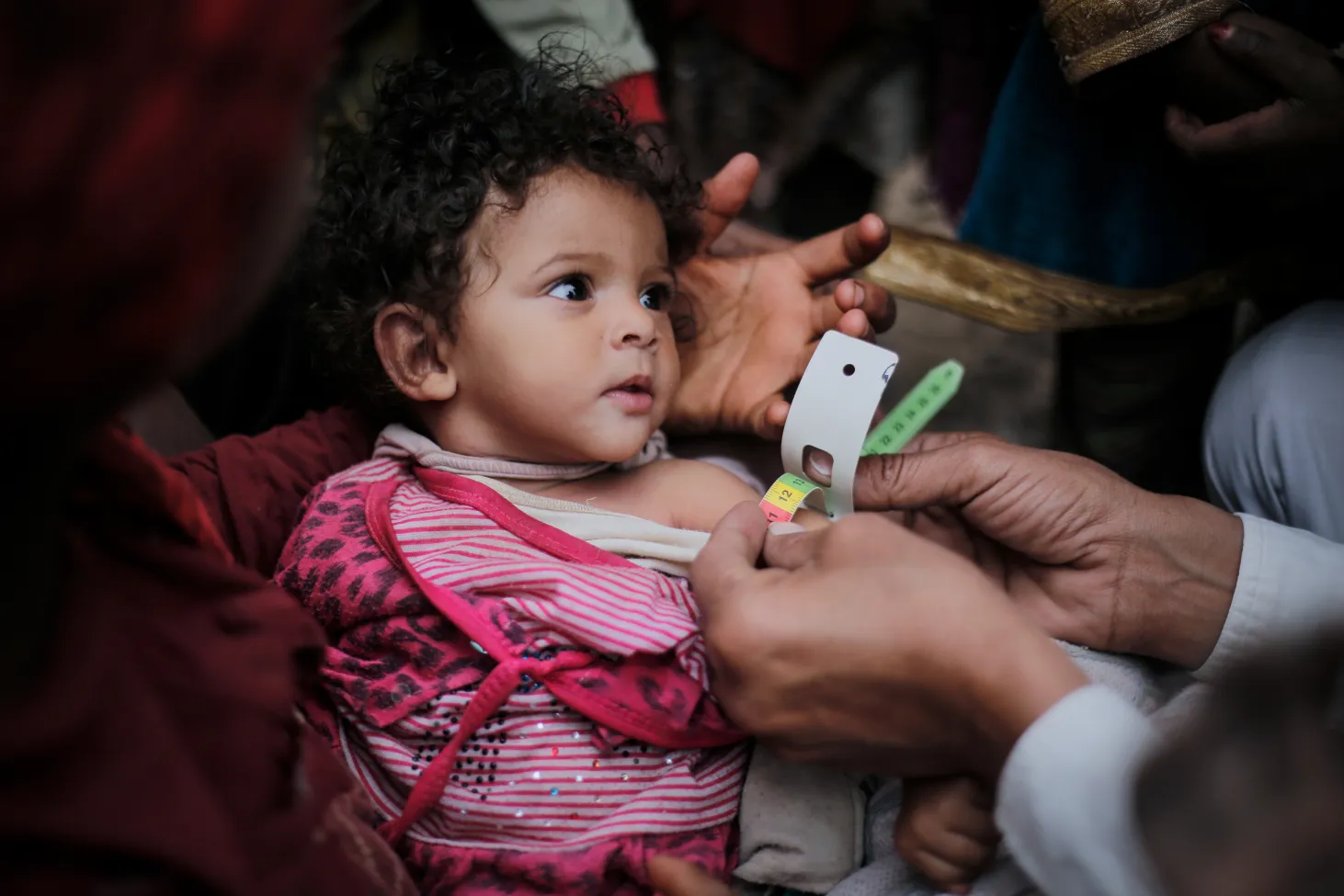 Un professionnel de la santé mesure la circonférence du bras d’un enfant souffrant de malnutrition sévère aiguë
