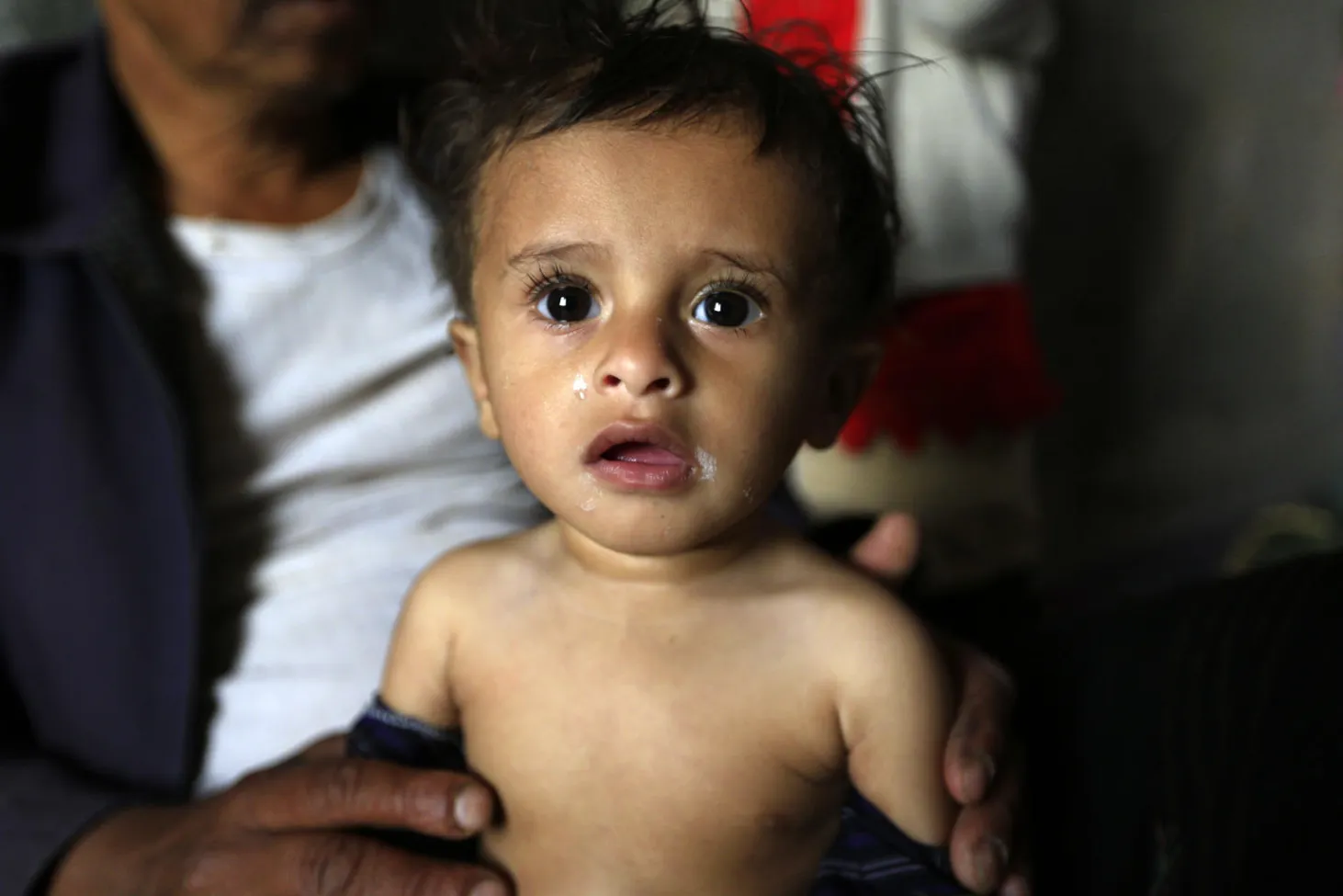 Yahya Hamoud Ali Al Huzef, un bambin yéménite de 9 mois, souffre de malnutrition. On le voit ici avec sa famille dans sa maison qui est située en périphérie de Sanaa, la capitale du pays.
