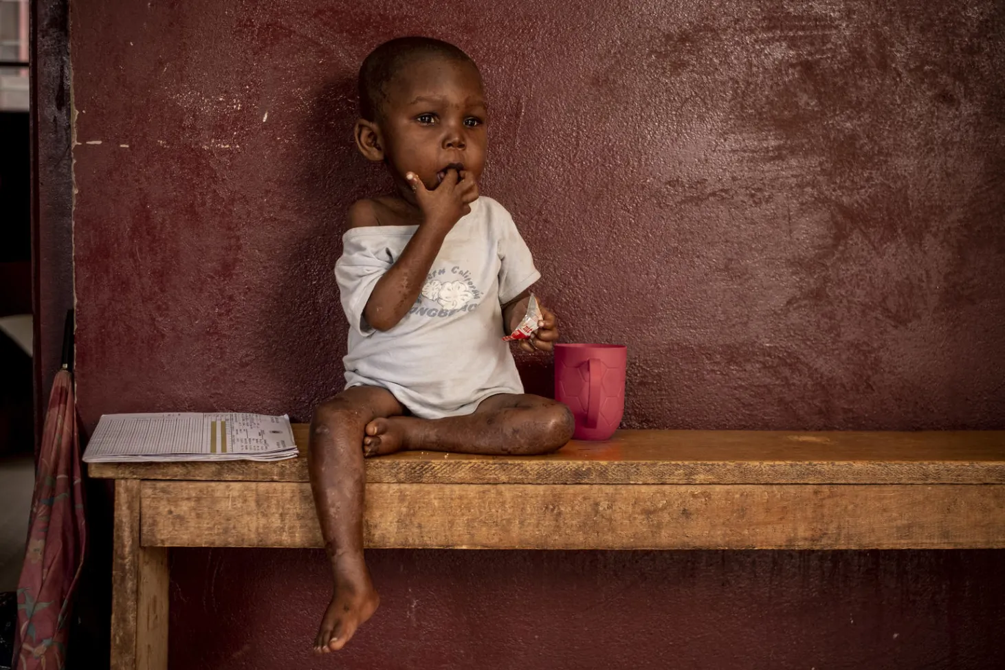 Un enfant mange dans une clinique pédiatrique soutenue par l’UNICEF à Bangui, en République centrafricaine.