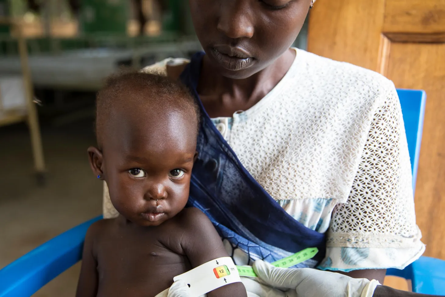 bebe, malnutrition, Soudan du Sud