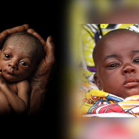 Baby Nahwa made a miraculous journey from a premature 2.6lb newborn to a healthy one 3 months later