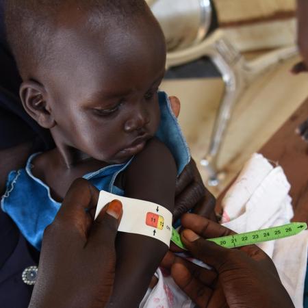 A health care worker is measuring children's upper arm circumference. 