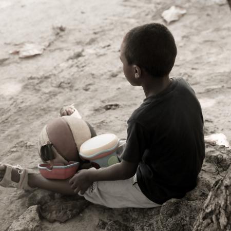 Mahery, 8, was repeatedly physically abused by his mother. Thanks to the support of social workers, he has received care and support from the child care center run by CDEF (the collective on the rights of children and the family) in the city of Mahajanga.