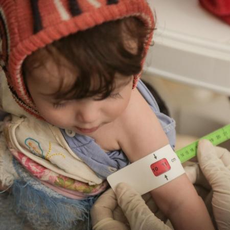 On 4 June 2020 in Yemen, Amal is measured while being screened for severe acute malnutrition at Arhab Health Centre in Sana'a Governorate.