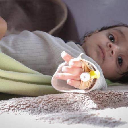 A baby gets measured for malnutrition