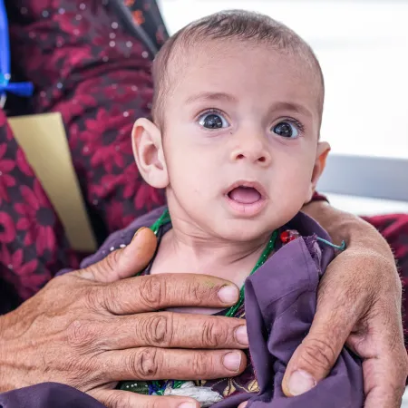 At the UNICEF-supported Inpatient Therapeutic Feeding Centre in Herat Regional Hospital, 15-month-old Javid who is suffering from severe acute malnutrition (SAM) with complication is provided with therapeutic food and medical care.