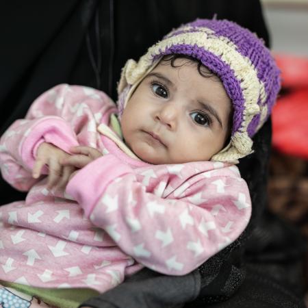 Ethar is 4 months old and recovering from malnutrition at the 22 May Hospital in Sana'a. There are currently over 360,000 children suffering from severe acute malnutrition in Yemen