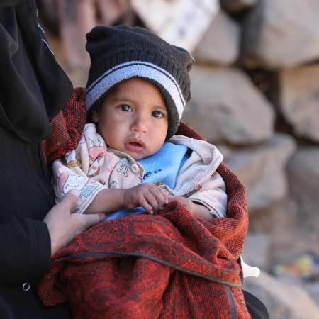 The beneficiary Abdulkarim Mohammed Saleh, one of the infants who were suffers of malnutrition and be treated by the UNICEF project in Alsari Village, Ibb Governorate, Yemen.