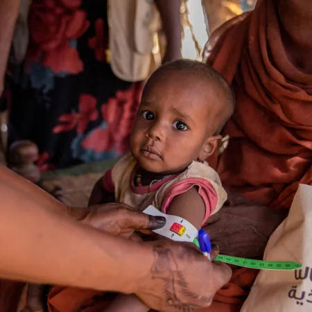 A health worker measures the upper arm of a young child sitting on a woman's lap with a colored band. The setting appears to be an aid center.