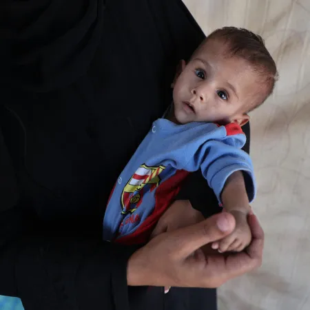 A malnourished baby in a blue and red outfit with a colorful emblem rests in his mother's arms, looking up with a tired expression. The person wears a black garment, suggesting a gentle and protective tone.
