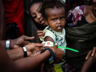 A health worker screens a young girl with a MUAC (Mid-Upper Arm Circumference) bracelet