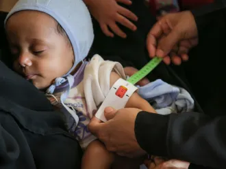 Salim is 7 months old, is screened by measure the upper arm circumference to check malnutrition.