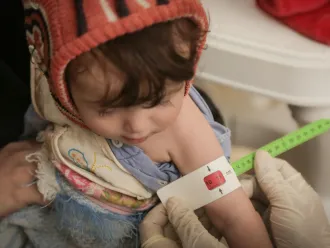 On 4 June 2020 in Yemen, Amal is measured while being screened for severe acute malnutrition at Arhab Health Centre in Sana'a Governorate.