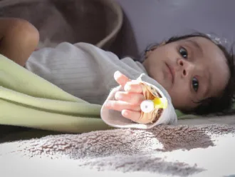 A baby gets measured for malnutrition