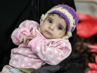 Ethar is 4 months old and recovering from malnutrition at the 22 May Hospital in Sana'a. There are currently over 360,000 children suffering from severe acute malnutrition in Yemen