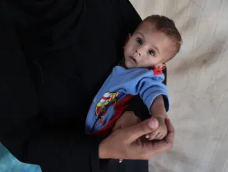A malnourished baby in a blue and red outfit with a colorful emblem rests in his mother's arms, looking up with a tired expression. The person wears a black garment, suggesting a gentle and protective tone.